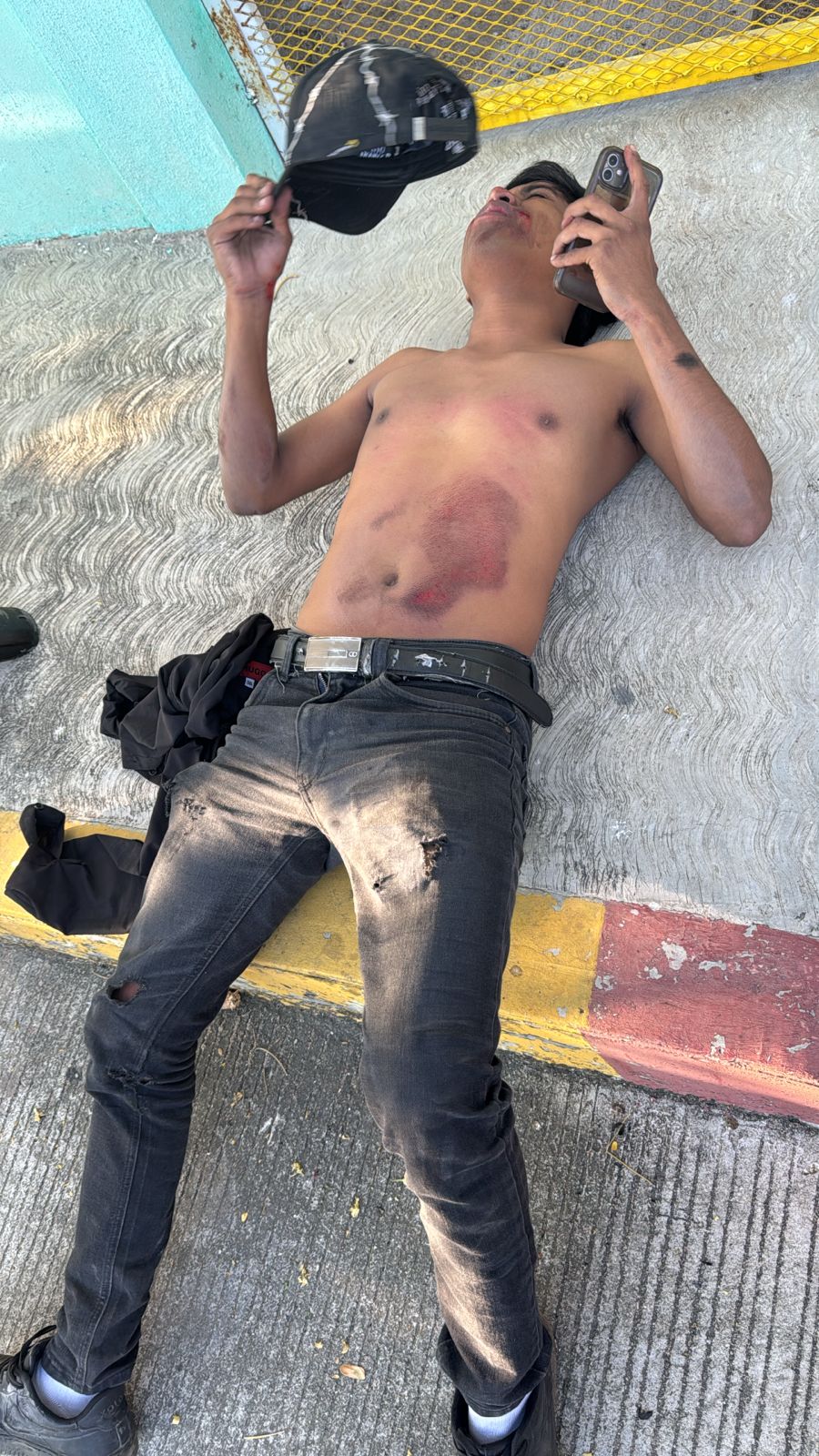 Cai¦üda de motocicleta deja a joven herido en Arriaga1