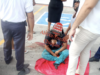 Accidente de motocicleta deja dos lesionados en cabecera de Tonalá