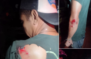 Motociclista resulta lesionado tras derrapar en la carretera Pijijiapan–Tonalá
